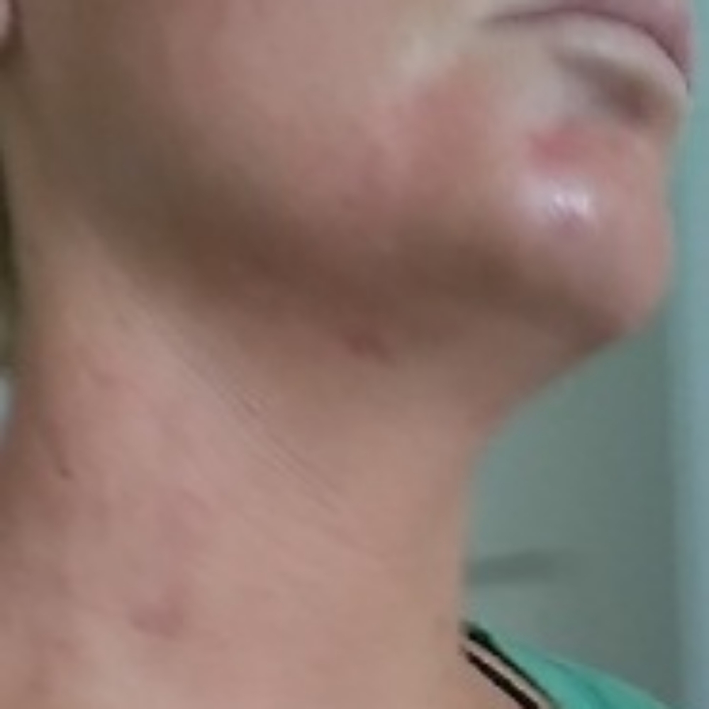 Help - Picture 4 of 4